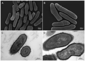 Immagini di Propionibacterium acnes al microscopio elettronico a scansione e a trasmissione - Alzheimer infezione batterica