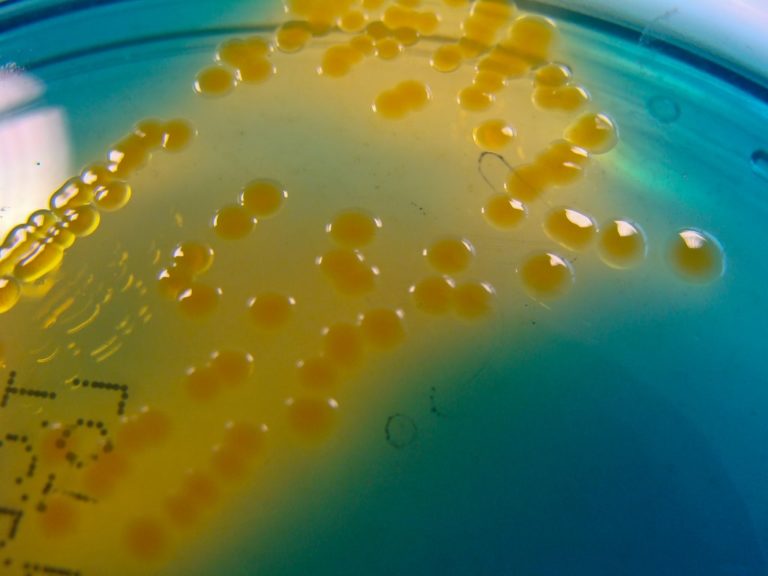 Vibrio Cholerae Scheda Batteriologica Ed Approfondimenti