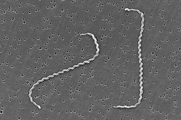 Leptospirosi Descrizione Della Patologia Ed Approfondimenti