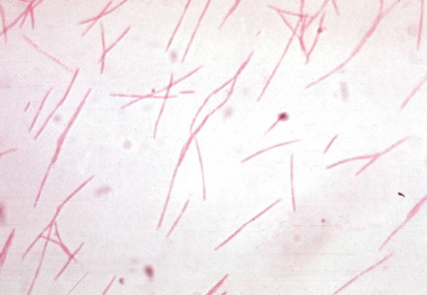 Figura 1 - Fusobacterium nucleatum