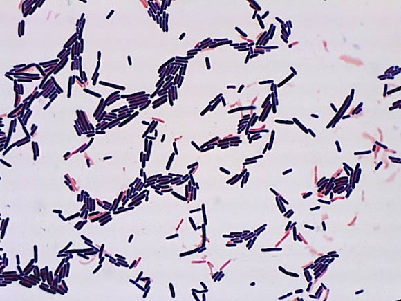 Lactobacillus. Лактобациллы Дедерлейна. Молочнокислые бактерии лактобациллы. Lactobacillus Acidophilus микроскопия. Лактобациллы хельветикус.