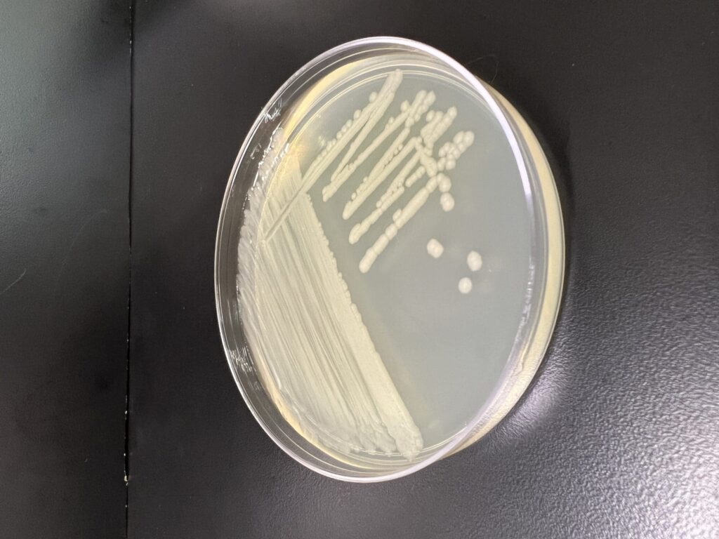 Pseudomonas putida: dalla bioremediation alla lotta al tabagismo