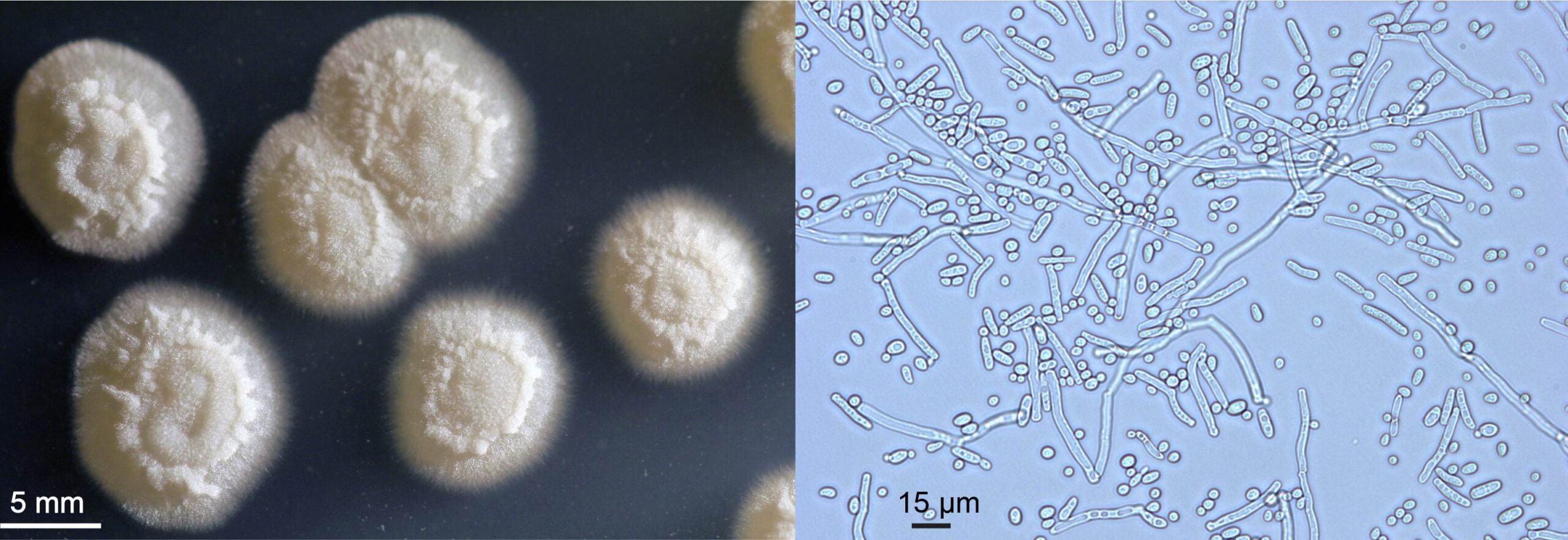 Figura 2 – A sinistra, colonie su terreno solido del lievito oleaginoso Yarrowia lipolytica; a destra, fotografia al microscopio ottico di cellule dello stesso microrganismo