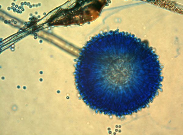 Figura 2 - Aspergillus parasiticus al microscopio