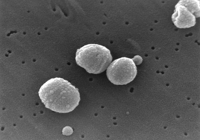 Figura 2 - S. pneumoniae al microscopio elettronico a scansione