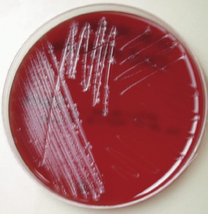 clostridium tetani blood agar