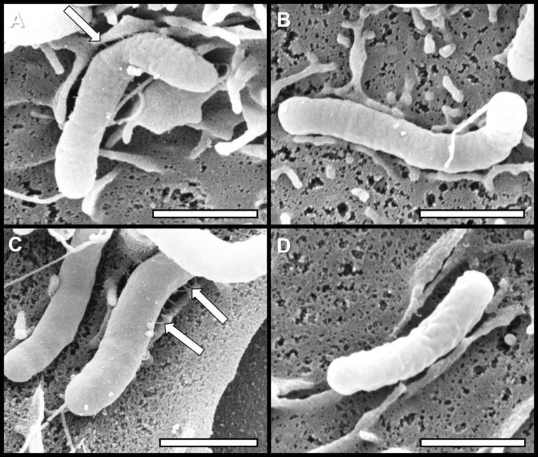 Helicobacter Pylori Sempre Dannoso O Anche Benefico Per La Salute 