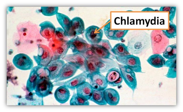 Chlamydia Trachomatis – Scheda Batteriologica Ed Approfondimenti