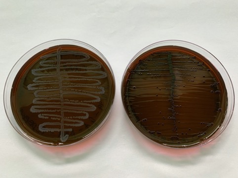 EMB Agar colonies