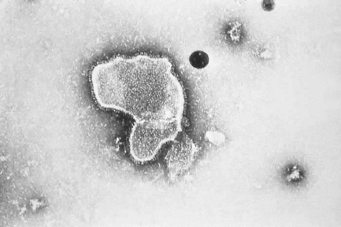 Virus respiratorio sinciziale umano al microscopico elettronico