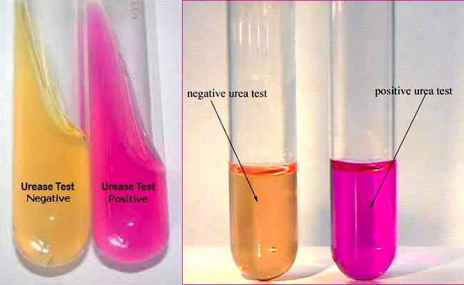 test dell'ureasi condotto con l'urea broth base terreno di Christensen