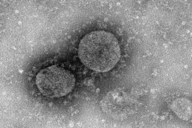 TEM coronavirus