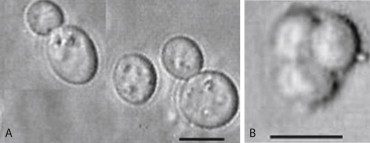 Saccharomyces carlsbergensis visto al microscopio elettronico a scansione