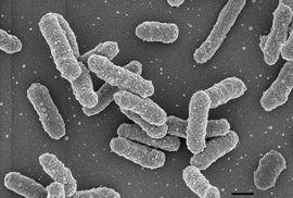 Immagine di Y. pestis al microscopio elettronico a scansione.