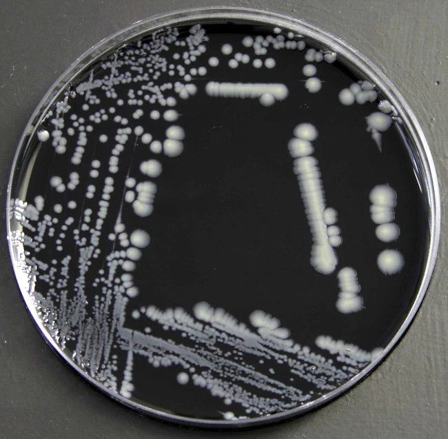 Colonie di Legionella pneumophila in agar BCYE 