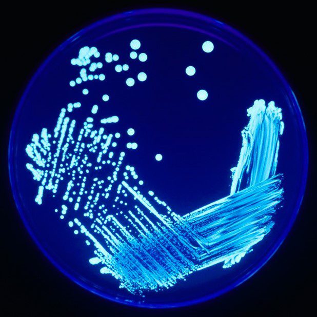 Coltura di Legionella pneumophila illuminata da luce ultravioletta