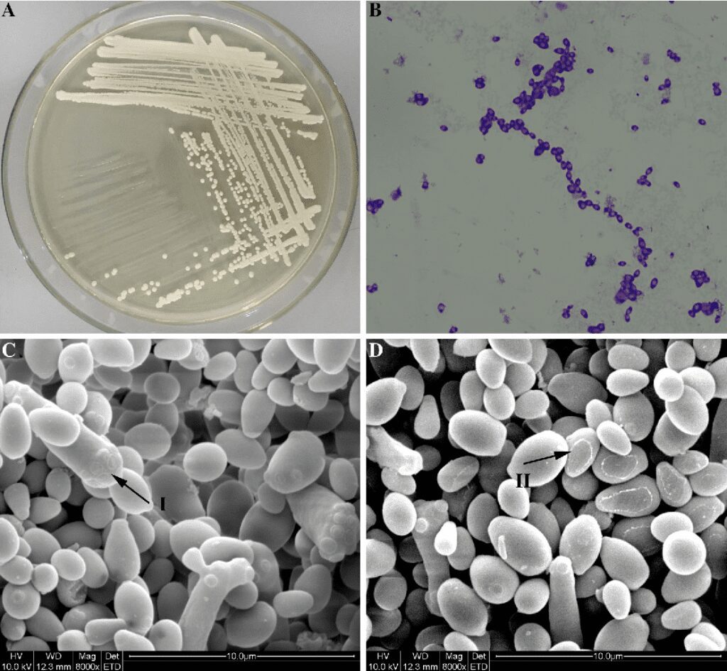 A) Caratteristiche morfologiche delle colonie di Meyerozyma guilliermondii; B) Fotografia al microscopio dopo colorazione; C, D) Immagini delle cellule di lievito al microscopio elettronico a scansione.
