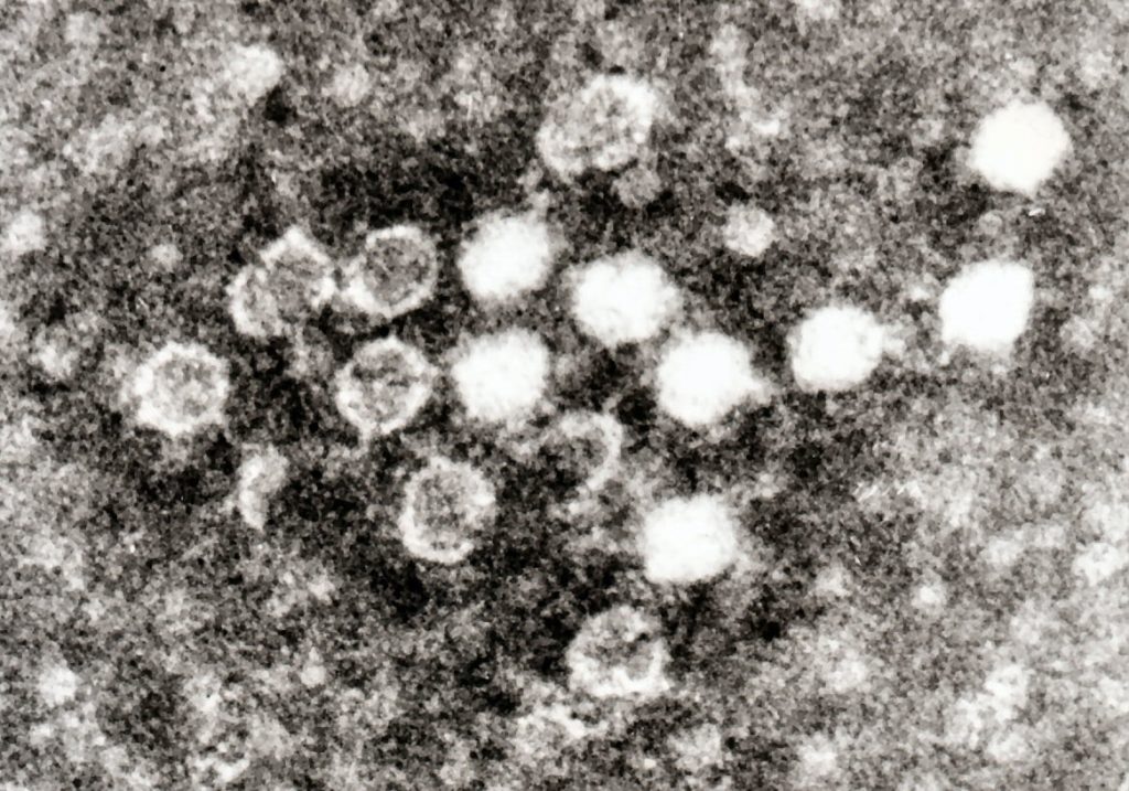 Parvovirus B19, principale responsabile, nella famiglia Parvoviridae, di malattie umane