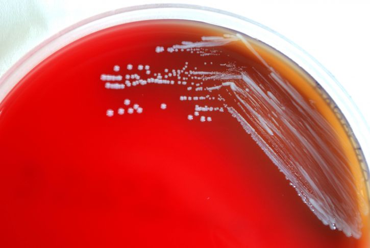 Brucella abortus in blood agar