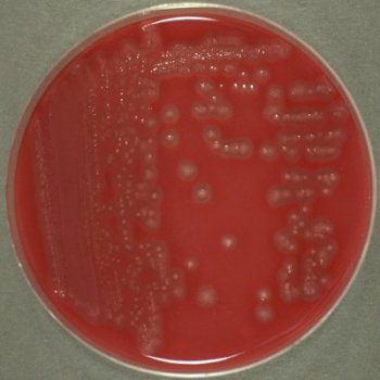 Clostridium perfringens in blood agar