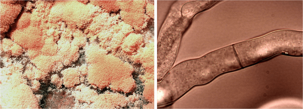 Aspetto macroscopico della N. crassa e ifa al microscopio ottico di N. crassa.