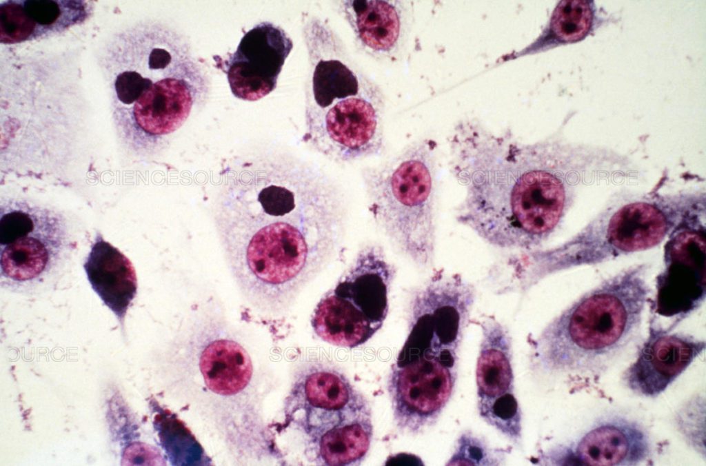 Inclusione di C. psittaci nelle cellule ospiti dopo la colorazione con Giemsa. Il corpo di inclusione è più scuro del citoplasma della cellula ma più chiaro del nucleo cellulare, che appare nero / viola.