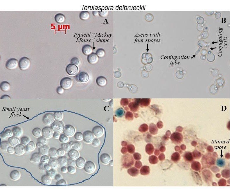 Torulaspora delbrueckii al microscopio con aschi e cellule in fase di coniugazione