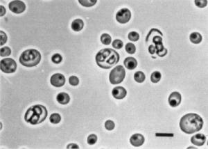 osservazione al microscopio di w. anomalus