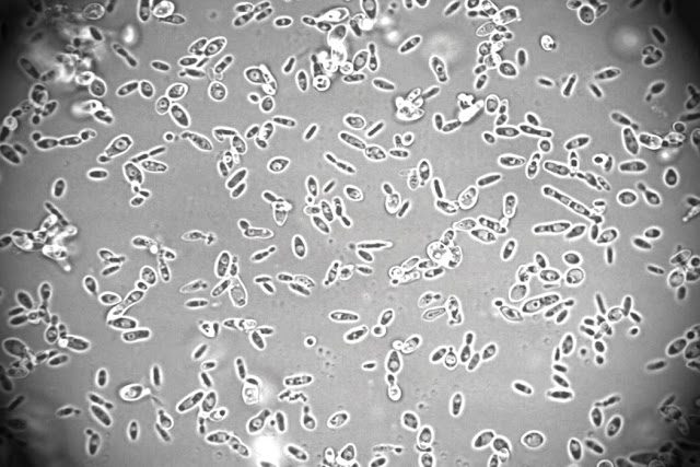 myces bruxellensis al microscopio