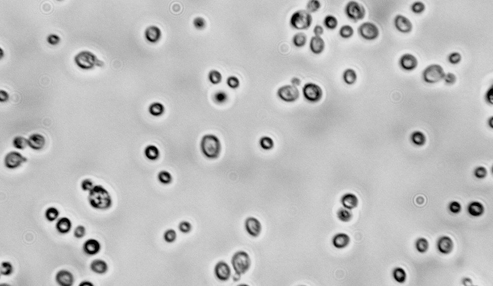 Osservazione di L. fermentati al microscopio