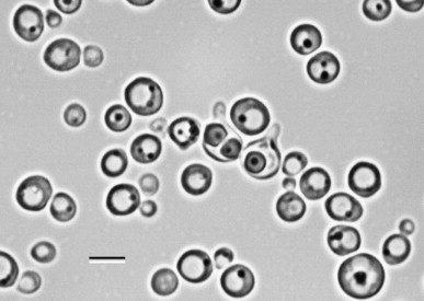 osservazione al microscopio di t. delbrueckii