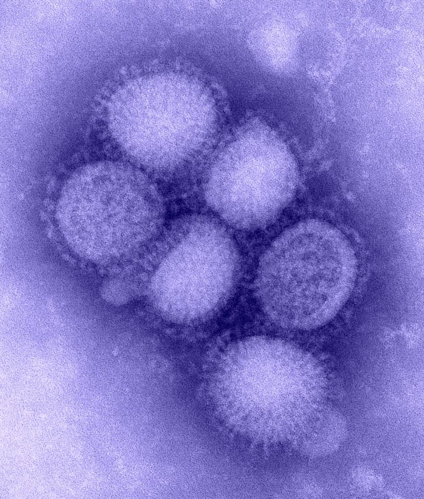 Figura 1 - virus dell'influenza suina del 2009