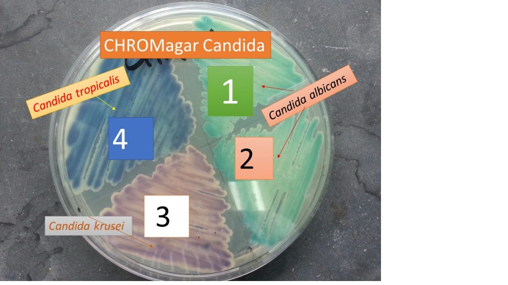 Su terreno CHROMagar si possono coltivare e differenziare varie specie di Candida componenti il "micobiota" intestinale umano.