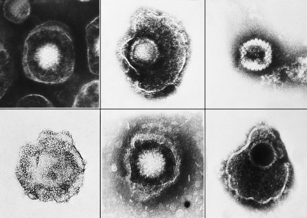 Vari virus della famiglia Herpesviridae osservati al microscopio elettronico