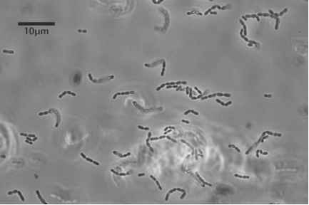 Oenococcus oeni
