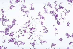 Lactobacillus lacti