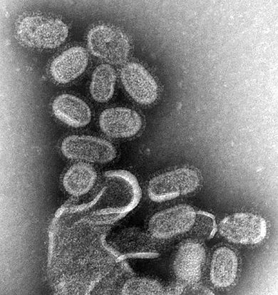 Influenza virus 