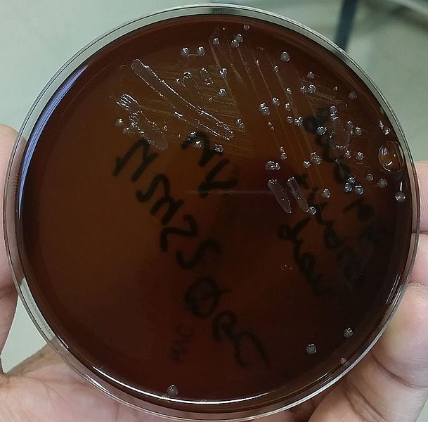 Crescita del batterio Neisseria gonorrhoeae su New York City agar
