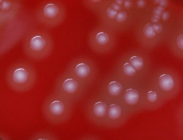 Figura 2 - Streptococcus bovis su agar sangue