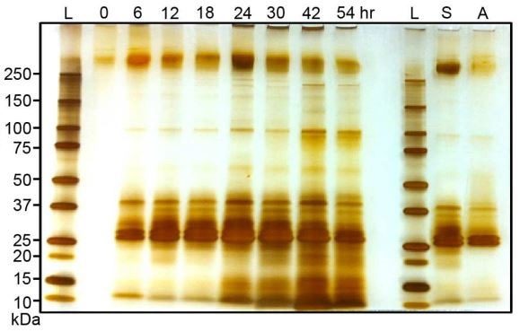 Figura 4 – Elettroforesi su gel dei prodotti di secrezione/escrezione raccolti a intervalli temporali differenti dall’attivazione del nematode. L: marcatore di peso molecolare, S: nematode associato col batterio, A: nematode axenico