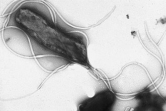 Helicobacter pylori responsabile della gastrite 