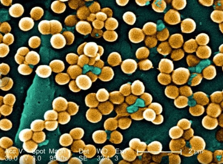 Staphylococcus aureus