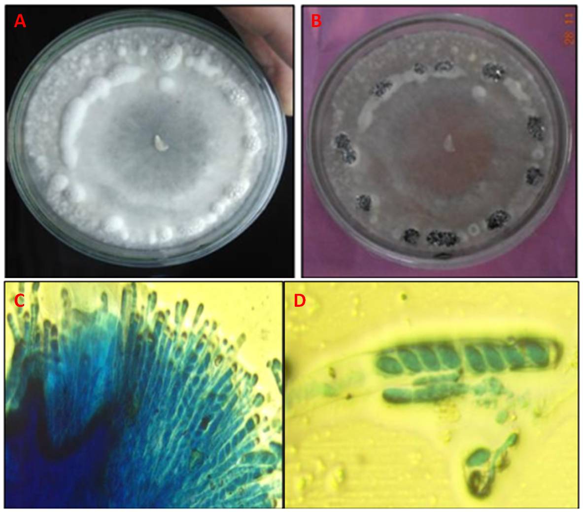 Figura 10 – Aspetti colturali e microscopici di S. sclerotiorum. A) Crescita delle colonie fungine su PDA; B) Formazione degli sclerozi; C) Disposizione degli aschi nella periferia dell’ascocarpo; D) Aschi con otto ascospore