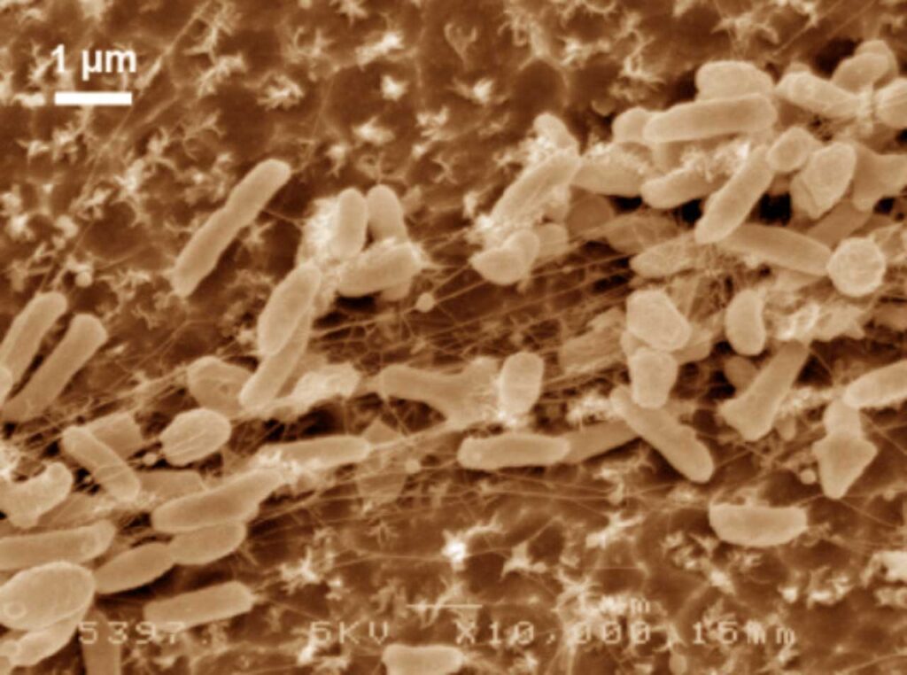 Ideonella sakaiensis microplastica e batteri