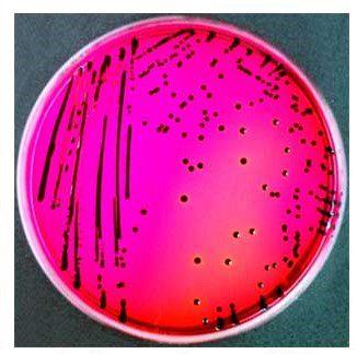 Figura 3 - crescita di Salmonella su terreno XLD agar