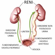 Schema andamento fisiologico e non fisiologico del flusso urina