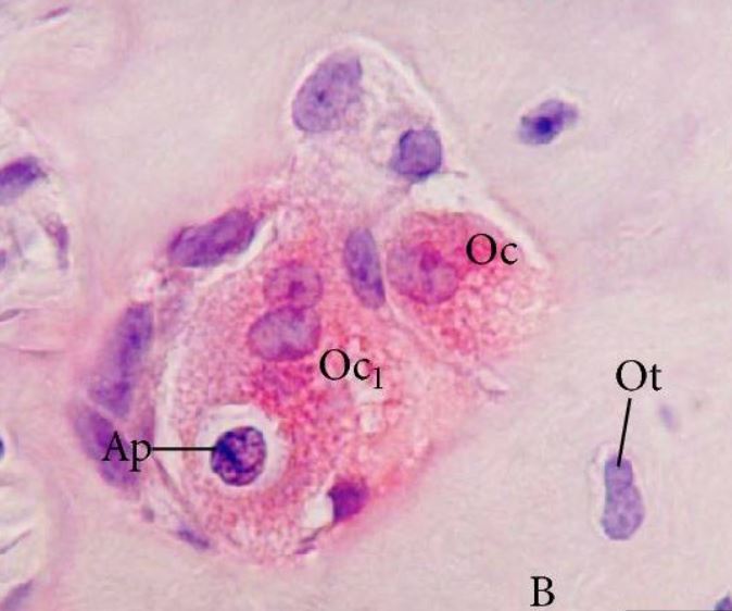 Tessuto osseo: osteoclasti