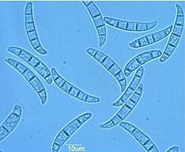 Macroconidi di Fusarium culmorum.