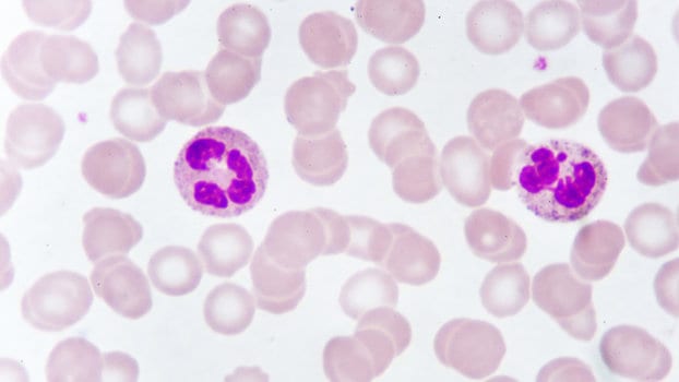 Gli eosinofili contengono granuli citoplasmatici che si colorano di rosso tramite eosina