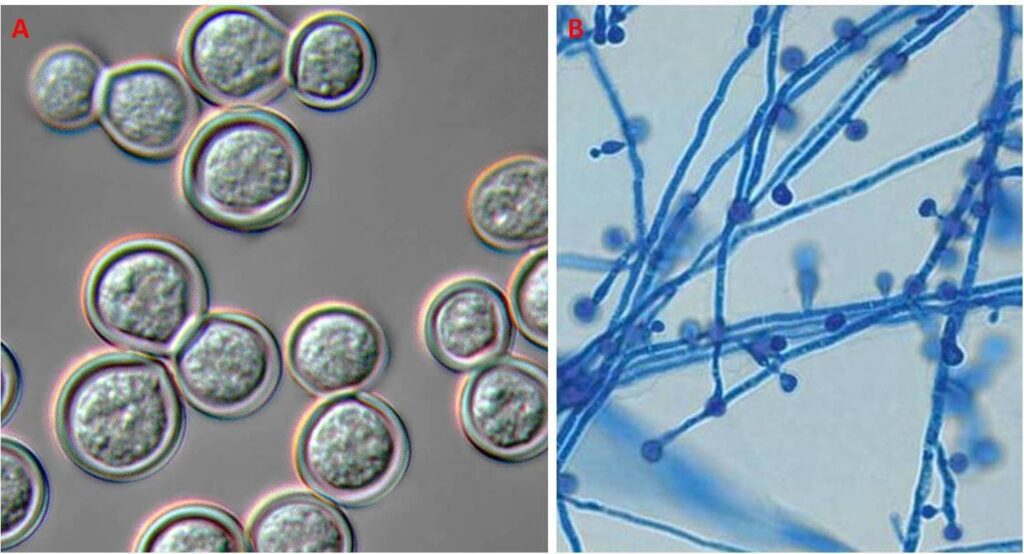 Blastomyces Dermatitidis - Scheda Micologica Ed Approfondimenti